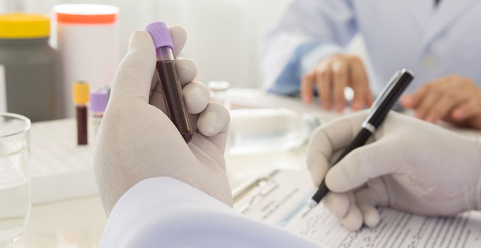 Blood Test